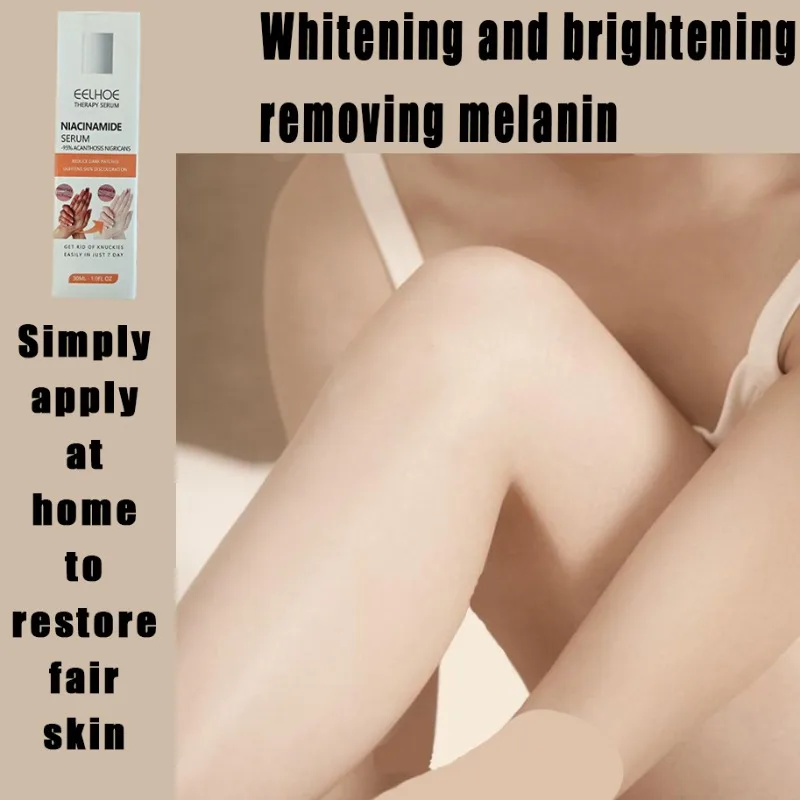 

Dark knuckles whitening serum Elbows Armpit Beaching SerumWoman Private Part Skin Removal Dark Knuckles Strong Whitening Serum