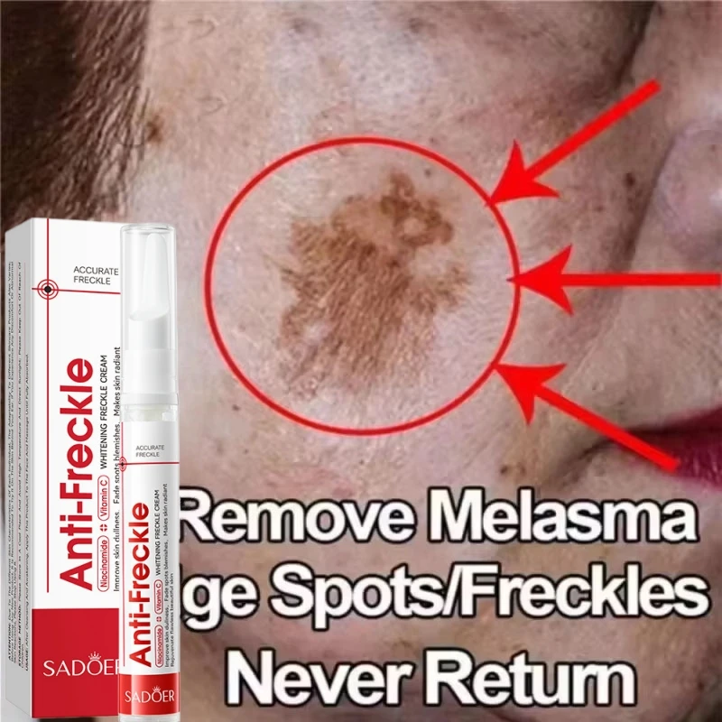 Anti Freckle Cream Face Brightening Creams Dark Spots Remove Acne Mark Fade Pigmentation Melasma Anti-aging Moisturize Skin Care