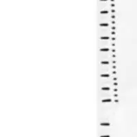 

Main Side Brush Bags Kit For MOVA Z60 Ultra Roller Complete Robot Vacuum Cleaner Part Non-woven Fabric Cleaning Machine Part