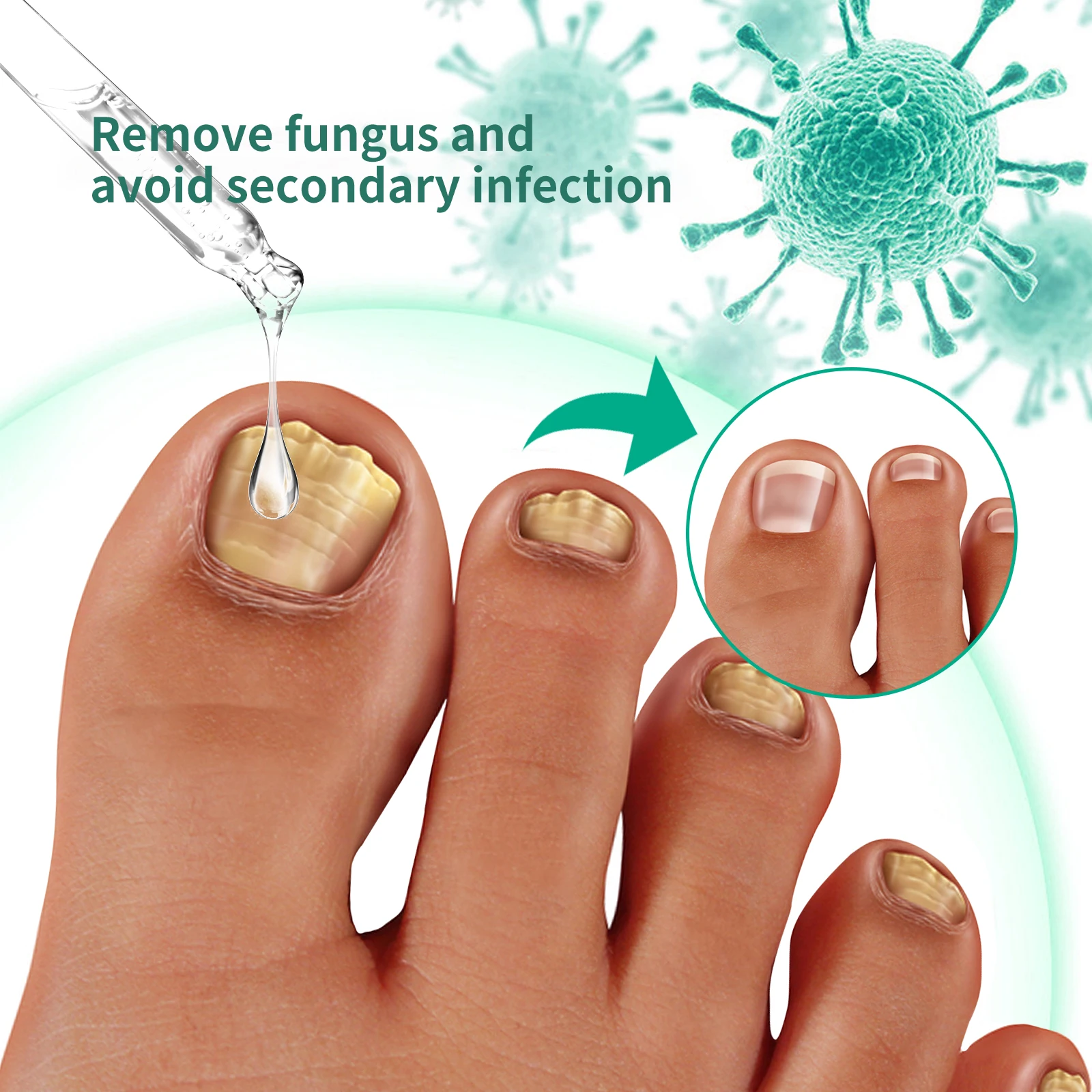 Toenail Fungus TreatmenT for Thick, Broken, Discolored and Damaged Nail 30ml