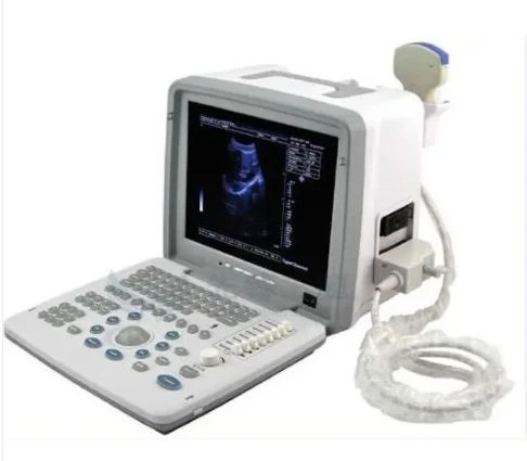 SY-A026 4d ultrasound machine Portable hd Ultrasound Machine B Mode Human Ultra Sound handheld vascular ultrasound