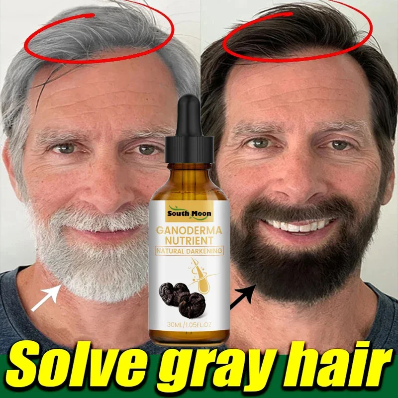Gray White Hair Treatment Serum Liquid White To Black Natural Color Repair Nourish Scalp Anti Loss Hair Care Products Men Women