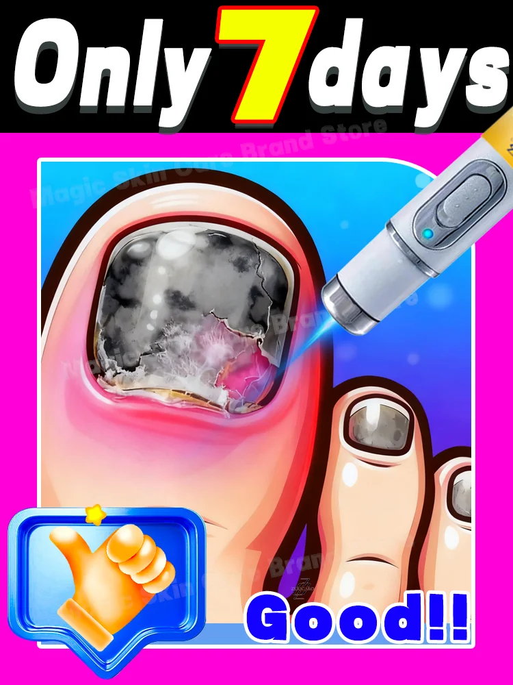 

Advanced repair technology gently penetrates to restore the natural color of fungus-infected nails.