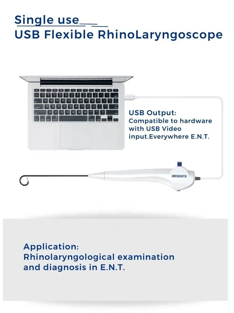 high quality Medical equipment trade portable disposable Flexible ENT Endoscope Set for nasal and laryngoscopy endoscopy