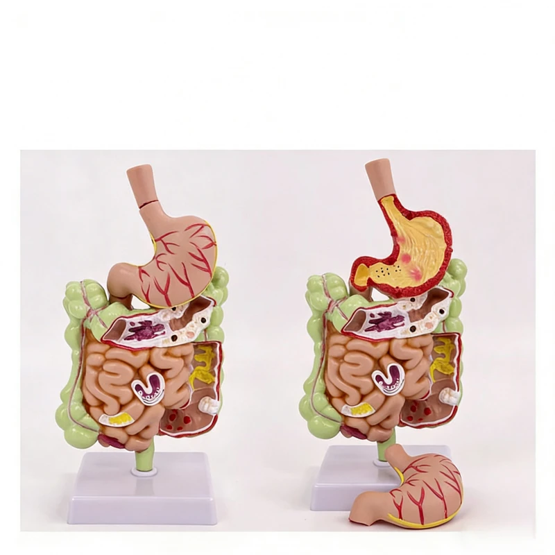 

Патологическая желудочно-кишечная анатомия человеческой толстой кишки, себяма, ректама и дахонной медицинской обучающей модели