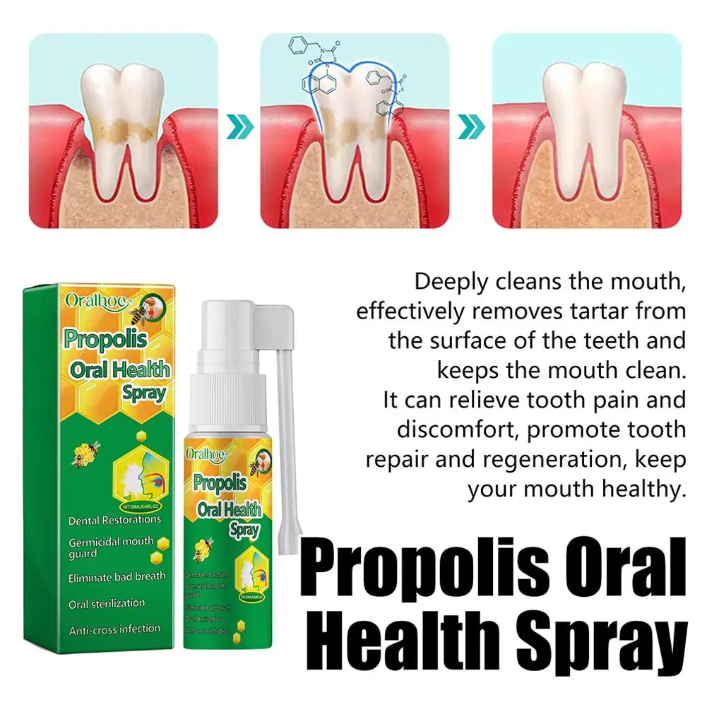 Própolis Spray para Proteção Dentes, Spray de Saúde Oral, Dente Respiratório Fresco, Proteção, Prevenção de Manchões Dentes, Removedor de Dentadura, Higiene Oral Dente Pessoal, 20ml