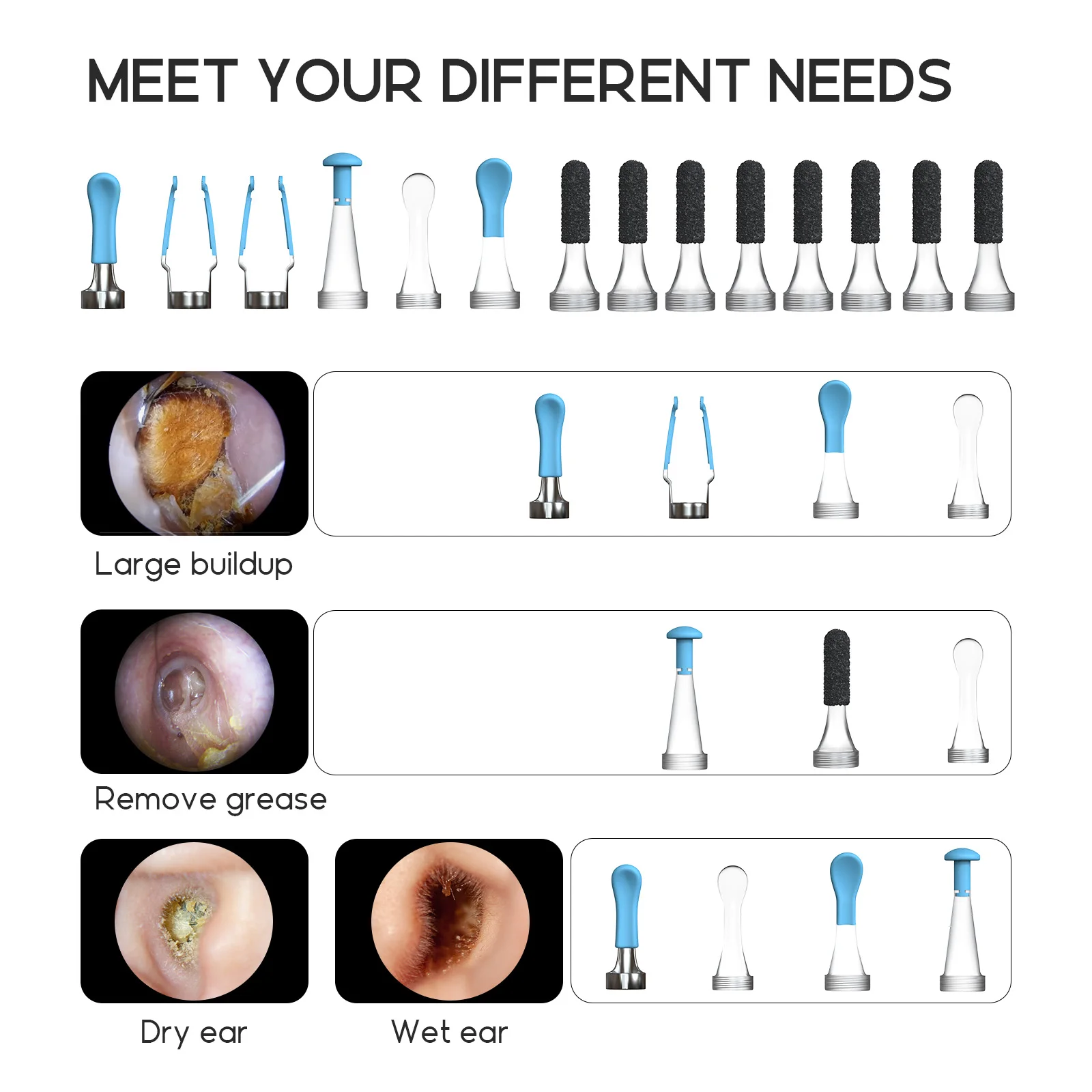 Original Bebird Accessories Earsight Plus Ear Tips Replacement Tool 14pcs/Set - Image 3