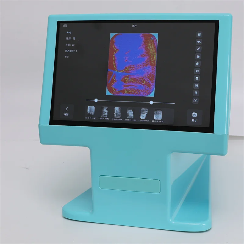 Alta Qualidade X Ray PSP Scanner, equipamentos Odontológicos