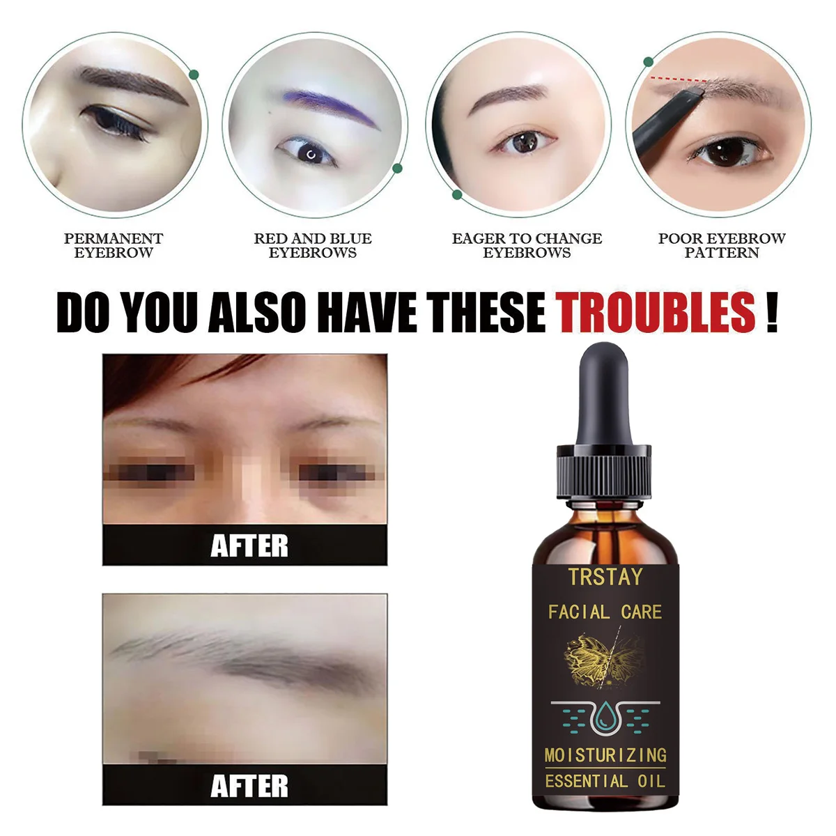 TATTOO REMOVE OIL EMBLEM CLEAN SKIN  pure natural essential oil can effectively lighten melanin