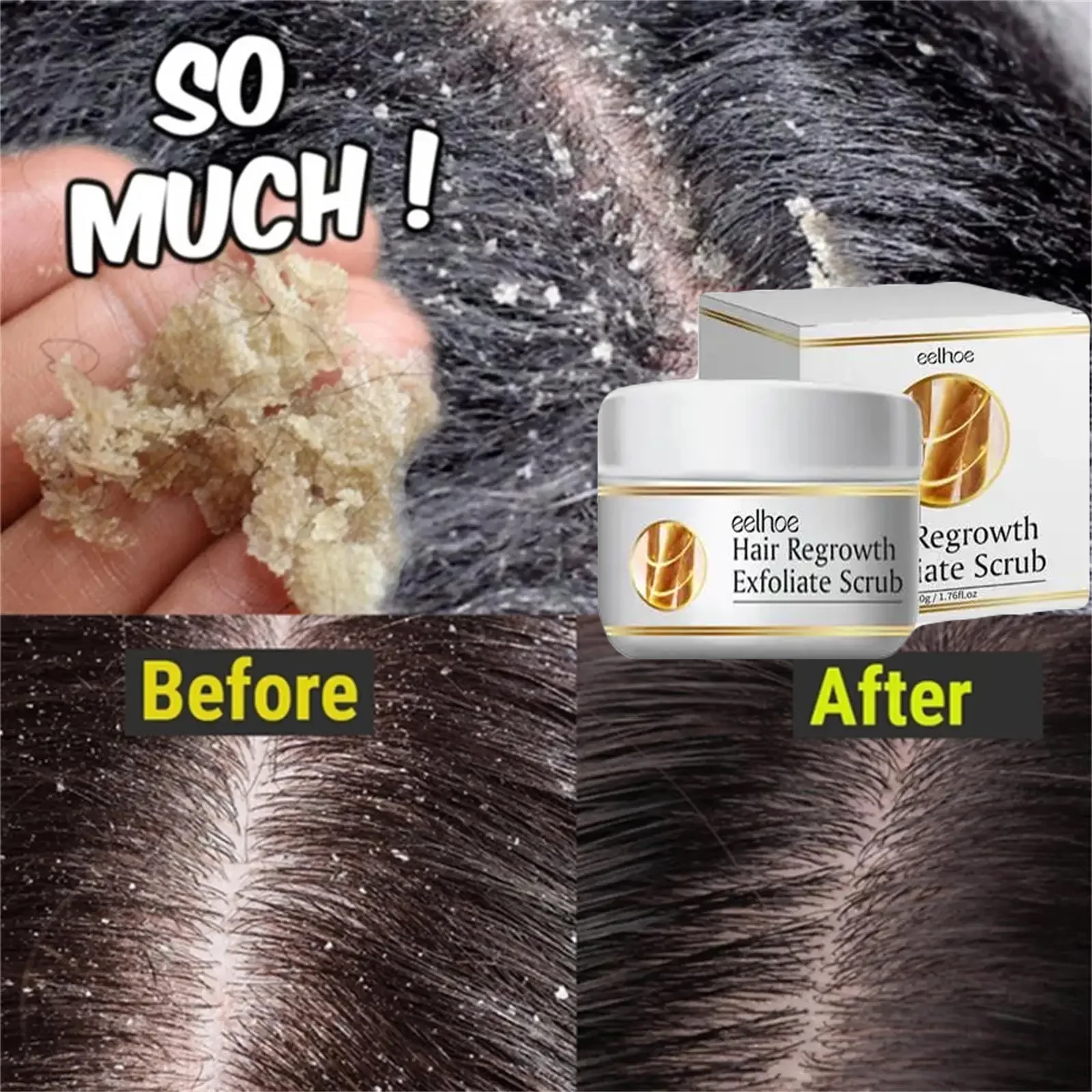 Fast Anti Dandruff Hair Treatment Scrub Itching Repair Scalp Cleaning Exfoliating Oil Control Antipruritic Hair Care Products