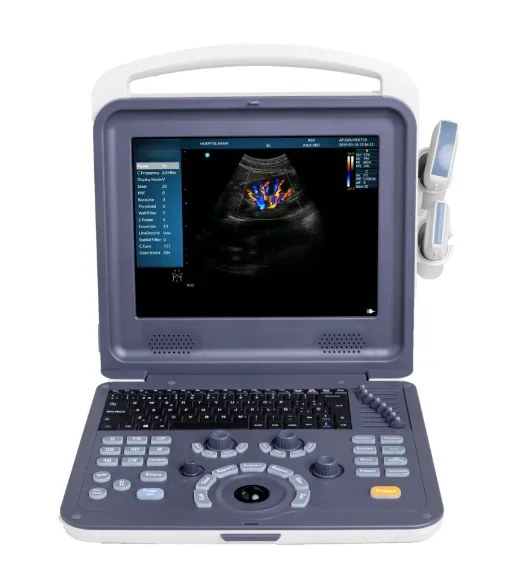 Amain Portable 12 inch Screen Full Digital Laptop Color Doppler Ultrasound Machine Ultrasonic Diagnostic System For Pet Or Human