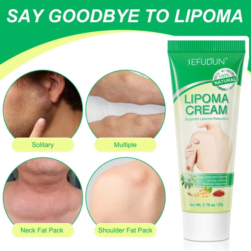 Lipoma Treatment Herbal Plaster Pain Relief Ointment Multiple Anti-Tumor Peeling Fat Mass Remover Cream Health Care Products