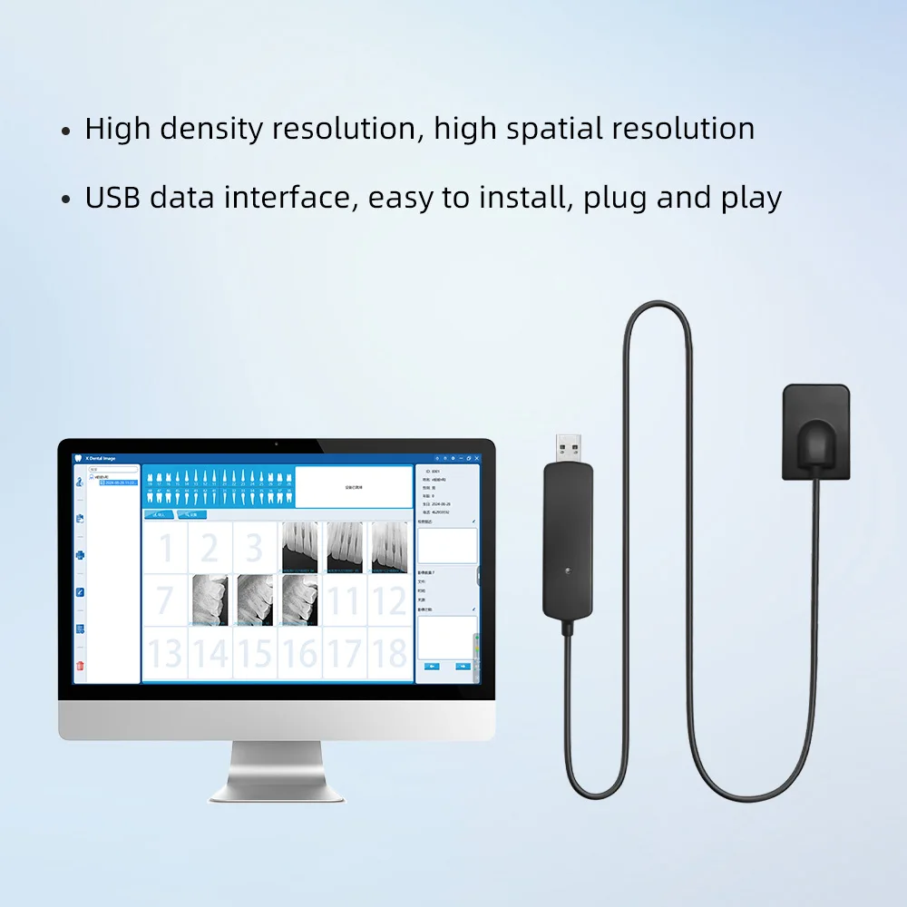 JINGT Dental X Ray Imaging System HD Digital Sensor Oral Film Camera High Definition Intraoral X-Ray Clinic Medical Equipment
