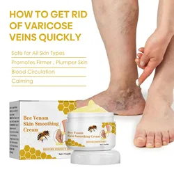 Bee venom vein repair cream reduces varicose veins, promotes blood circulation and vasoconstriction Leg Care Essence