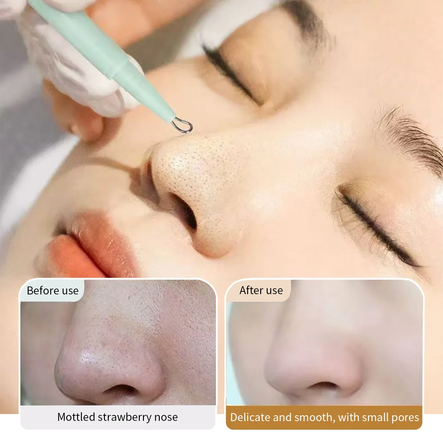 مزدوج الرؤوس السوداء حب الشباب بثرة الإبر العيب Comedone النازع مزيل الفولاذ المقاوم للصدأ التنظيف العميق المسام أدوات العناية بالبشرة