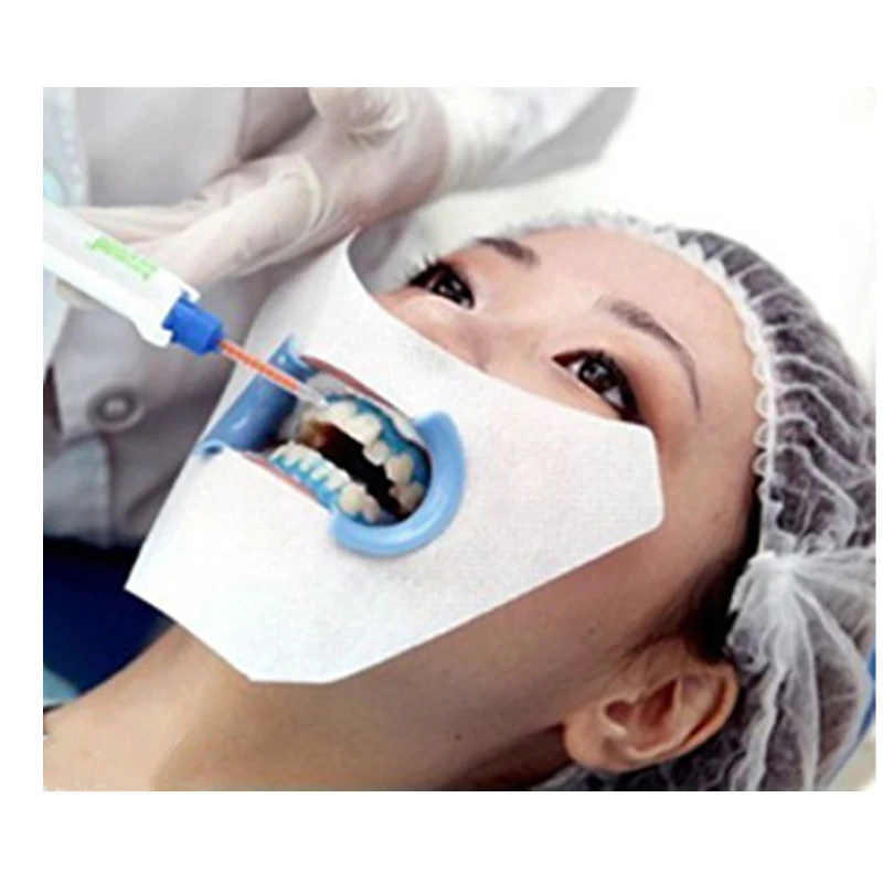 

100PCS DentalTeeth Whitening Face Gauze Dental Face Mask Mouth Mask for Teeth Whitening Teeth Whitening Accessory