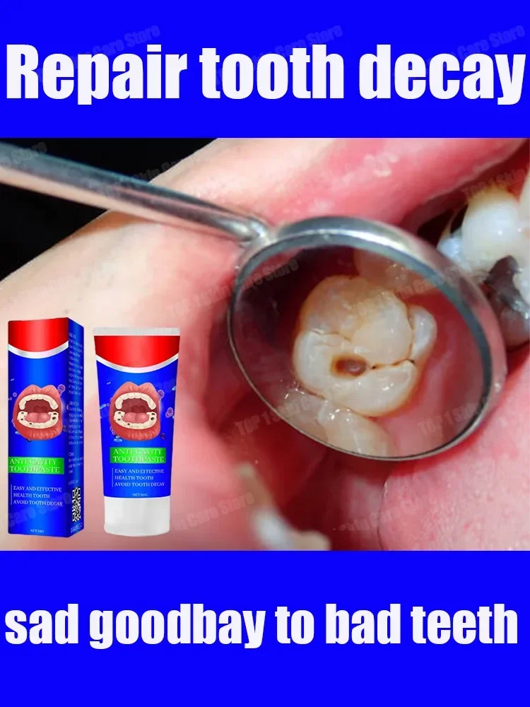 

Repair tooth decay treatment Teeth whitening anti-cavity fresh bad breath remove plaque toothache relieve periodontitis