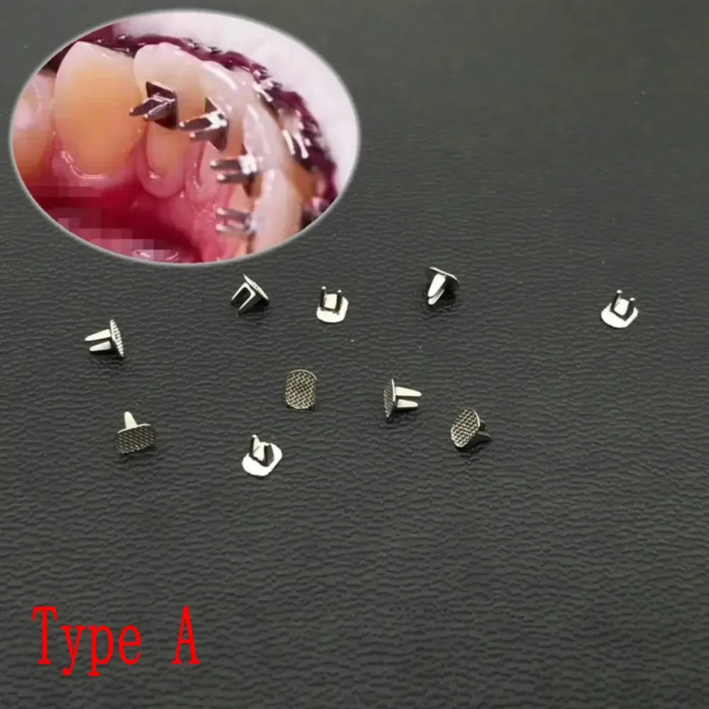 

10ps/pack Dental Bite Turbos Orthodontic Tongue Tamer Habbit Correction Button Orthodontic Bondable Bracket Dental Bite Turbo