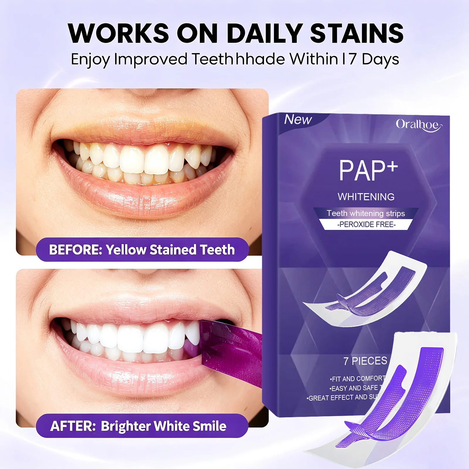 Teeth Whitening In Office - Advanced Purple Teeth Whitening Strips Color