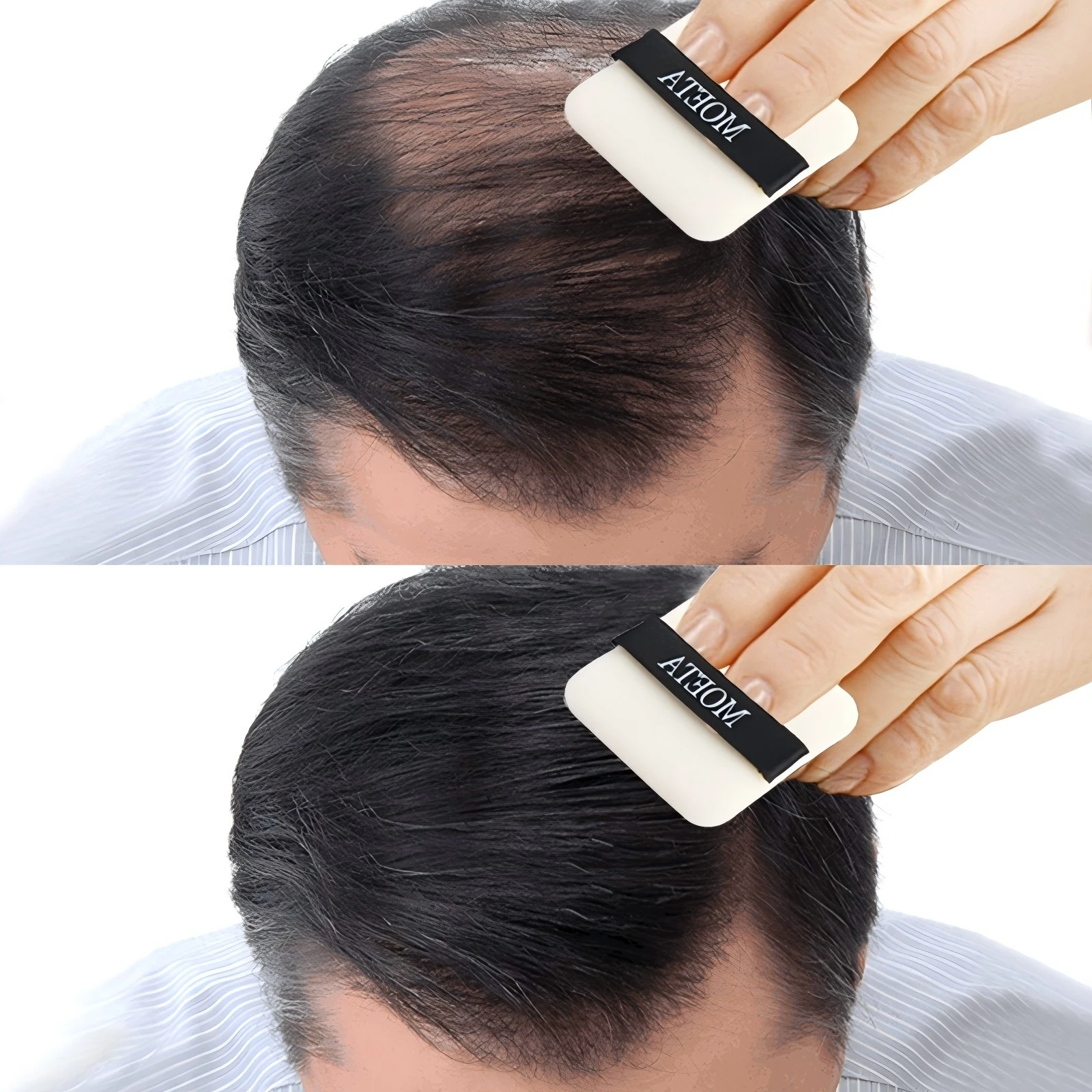 

Hair Growth Essential Loss Regrowth Treatment Strengthens Hair Nourishes Scalp Light Weight Non Greasy Improve Scalp Circulation