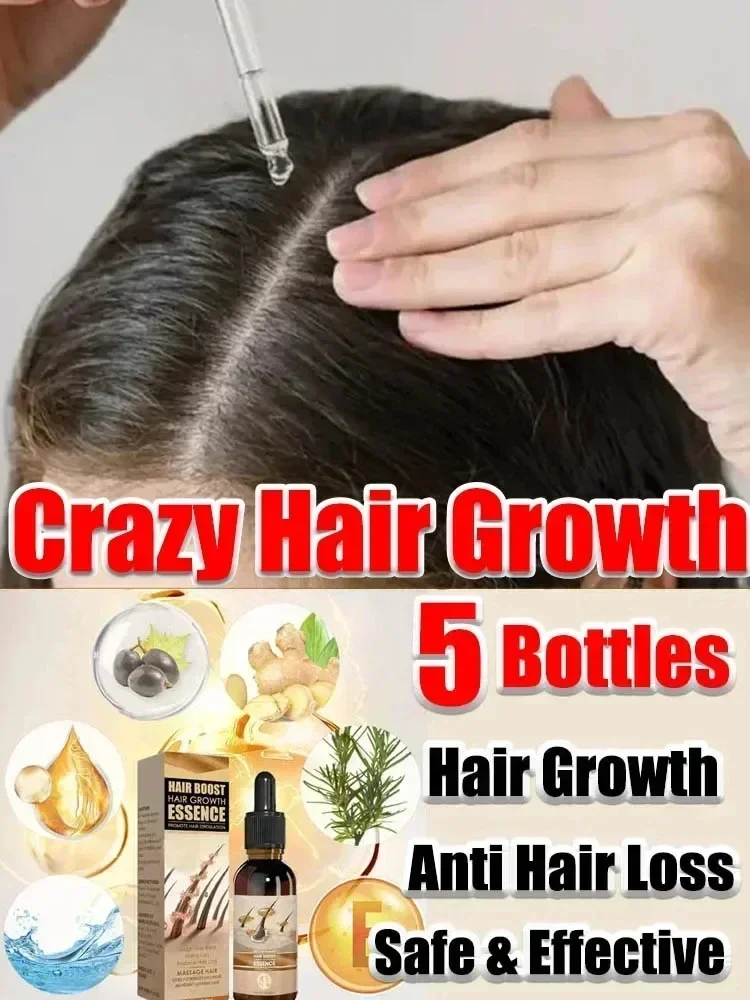 Hair Growth for Men Women Fast Growing Products Essential Oils Ginger Anti Hair Loss Scalp Treatment Hair Care