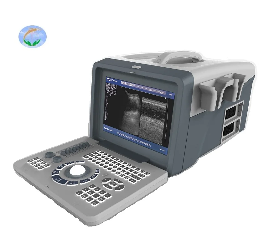 

Ce Approved Medical Ultrasound Machine YJ-X218 Full Digital LED Portable Ultrasound Scanner b scanner for Ob gyn