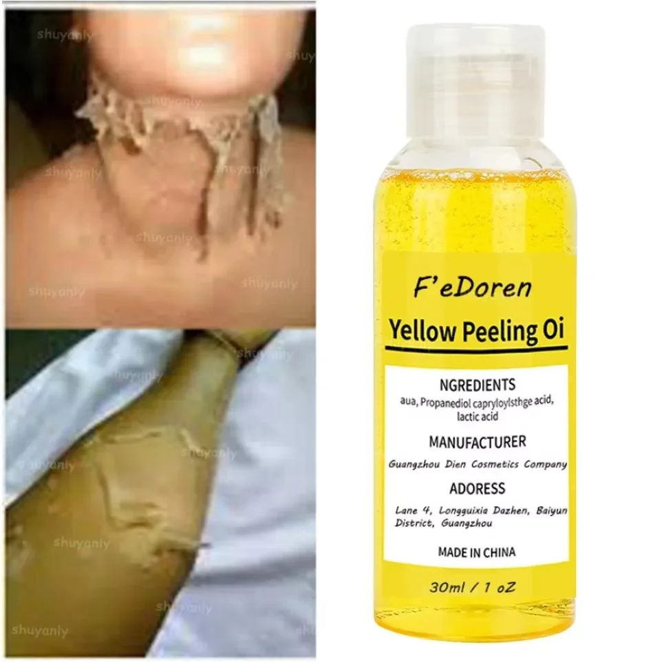 Óleo amarelo esfoliante para pele escura, adequado para pele escura O óleo esfoliante forte, ilumina a pele, hidrata e ilumina a melanina