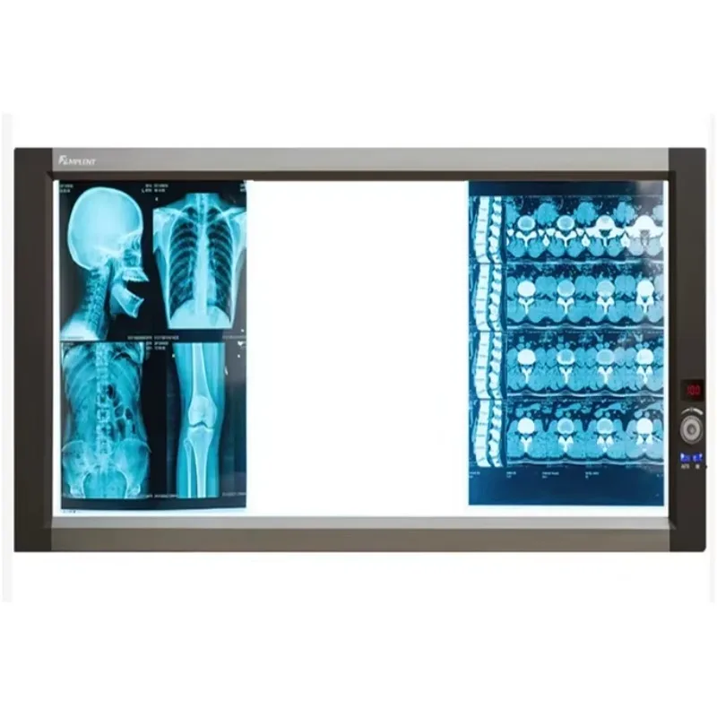 2025YSX-GPD03 X Ray Machine Triple LED XRay View Box Medizinisches Röntgenradiologiesystem Film Viewer Krankenhaus Röntgenbox Preis
