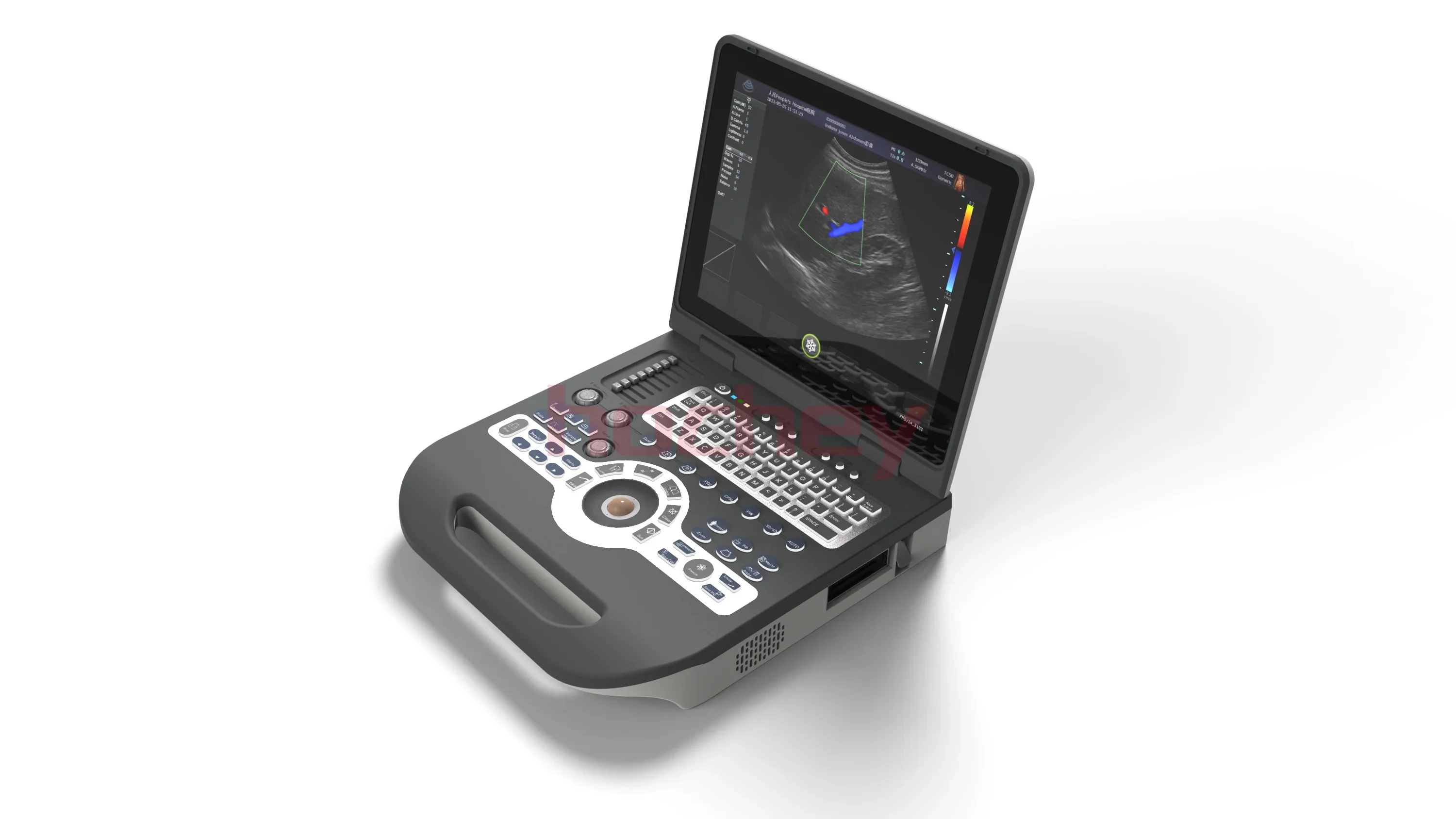 MT MEDICAL Portable Laptop 2D 3D 4D Color Doppler Ultrasound Scanner Machine for Veterinary and Human