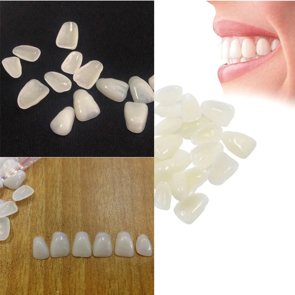 70PCS/Package Beauty Veneers Whitening Ultra-Thin Porcelain Teeth Resin Teeth Upper Anterior Dental Films