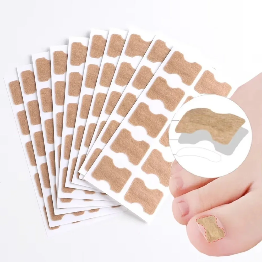 100Pcs Adhesive Ingrown Toenail Correction Stickers Elastic Nonwoven Flexible Ingrown Toenail Patches Breathable