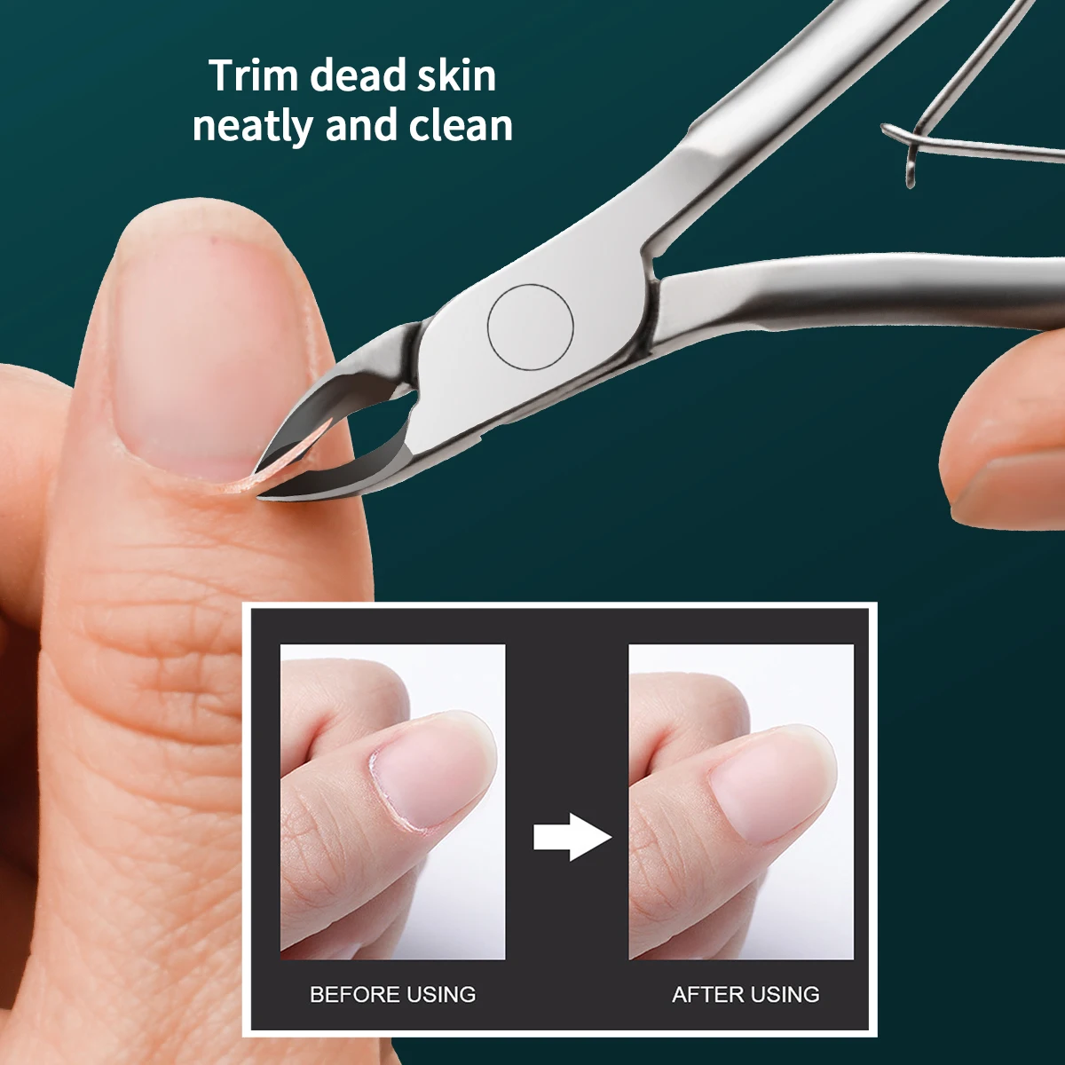 Pinze a taglio in acciaio inossidabile a forma russa per rimuovere i barbe della pelle morta