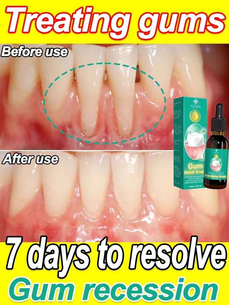 It is helpful and useful for you, and it can help your gums recover and become beautiful.