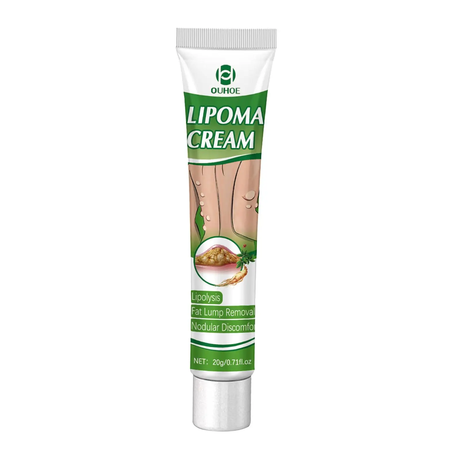 Crema per la rimozione del lipoma da 0,71 fl.oz Crema portatile per la cura della pelle Disagio nodulare Rimozione del lipoma