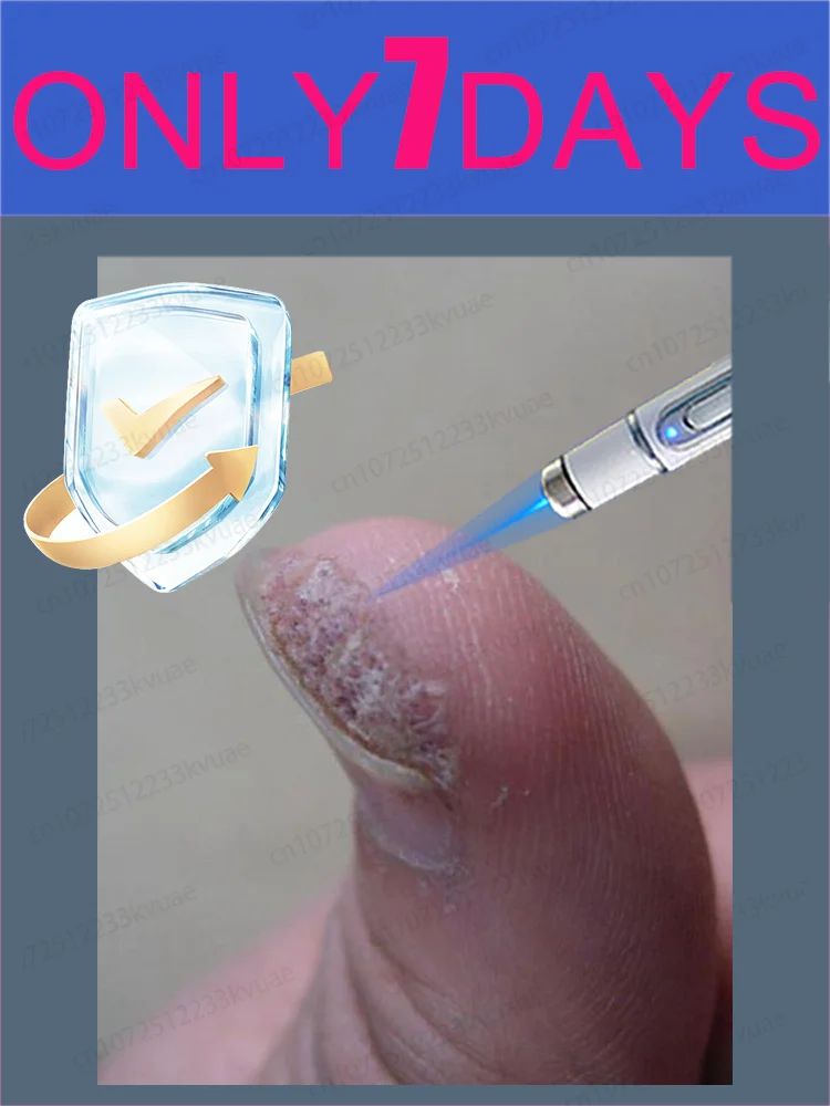 

Gᵉⁿᵉʳᵃᵗⁱᵒⁿ ᵘᵖᵍʳᵃᵈᵉᵈ wᵃʳᵗ ⸴ ʳᵉpᵃⁱʳ wᵃʳᵗˢ ʳᵒoᵗ ⸴ ᑫᵘⁱᶜᵏˡʸ 1st