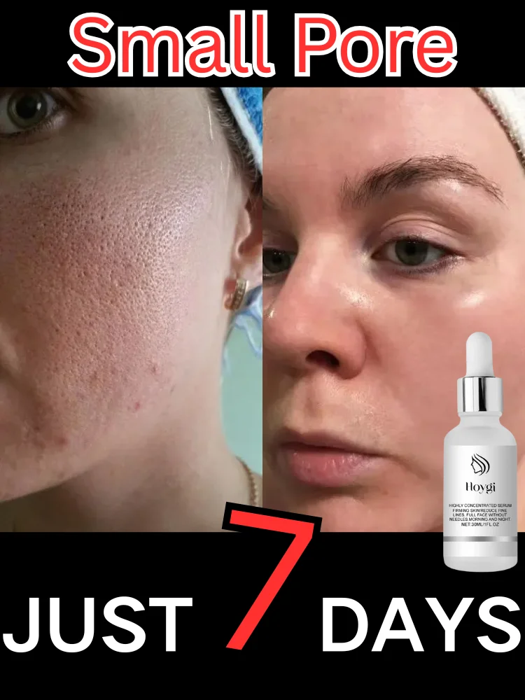 

Remove Large Pores Serum Lactic Acid Facial Pore Shrinking Repairing Products Pore Minimizing Firming Smooth Korean Skin Care