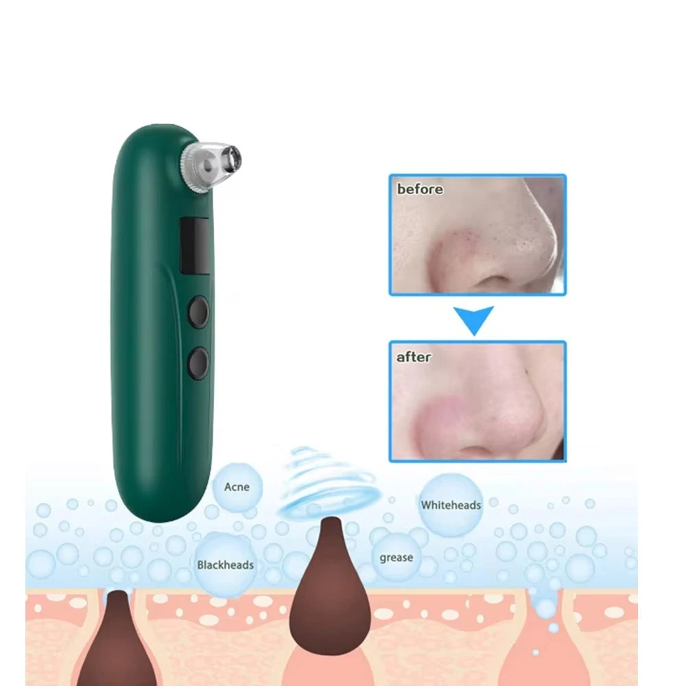 مصاصة الرؤوس السوداء الكهربائية، مزيل الرؤوس السوداء وحب الشباب، مستخرج الوجه الساخن، مزيل الرؤوس السوداء البصرية، آلة تنظيف عميق للوجه #2