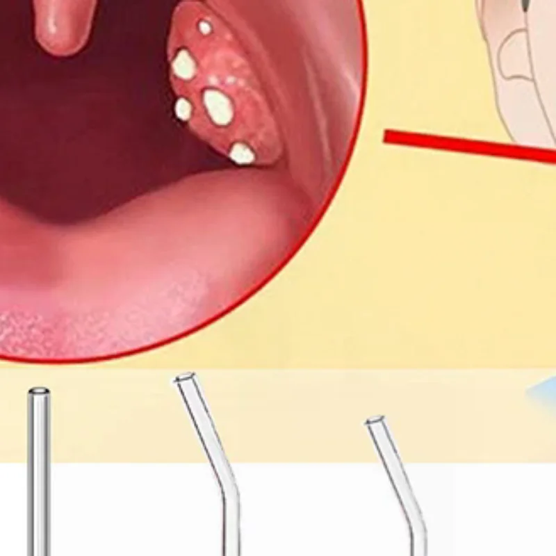With Cleaning Brush Arc Tonsil Stone Remove Tool Manual Style Cleaner Removal Tonsil Care Wax Stone Tools Air Tool