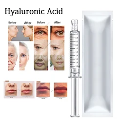 2ml Hyaluronic Acid Serum Lip/Nose/Cheek Hyaluronic Acid Crosslinked HA Lips Enhancement for Hyaluron Pen Remove Wrinkles  Kroea