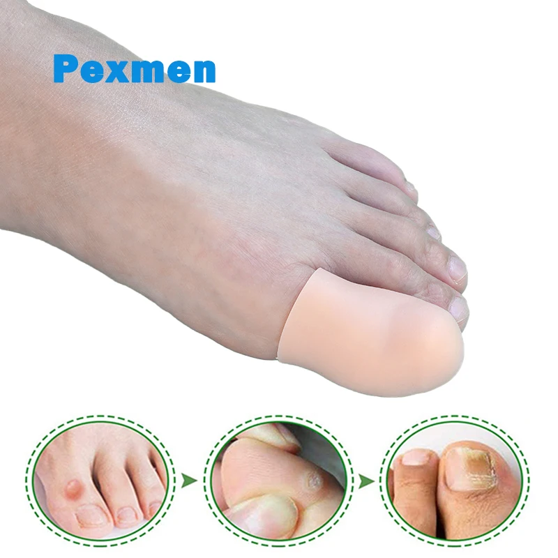 Pexmen 2/4pcs Gel Big Toe Caps umfasst Prävention für Hühner augen Blasen und ein gewachsene Zehennägel Fuß Schmerz linderung Zehen ärmel Schutz