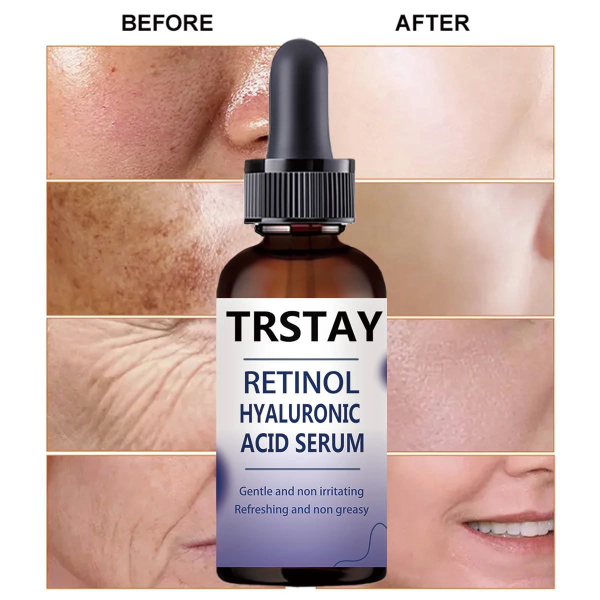 Retinol Hyaluronic Acid Serum, Gentle and Non-Irritating, Refreshing and Non-Greasy, Helps Improve Skin Condition