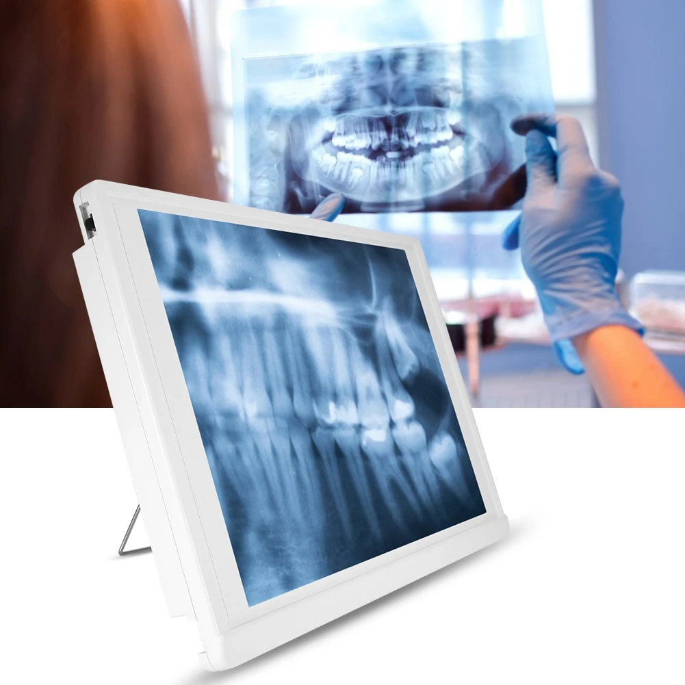 

Dental Equipment X-Ray Film Illuminator Light Box X-ray Viewer Light Panel Screen Dentist Oral Hygiene Panorama Viewbox Tools