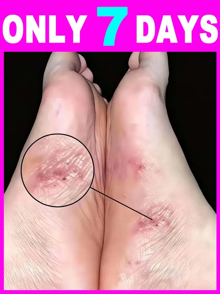 Fᴏᴏᴛ Cᴀʀᴇ Sᴘʀᴀʏ Cᴀɴ Sᴏғᴛᴇɴ Aɴᴅ Mᴏɪsᴛᴜʀɪᴢᴇ Fᴇᴇᴛ，Feel relaxed in your feet