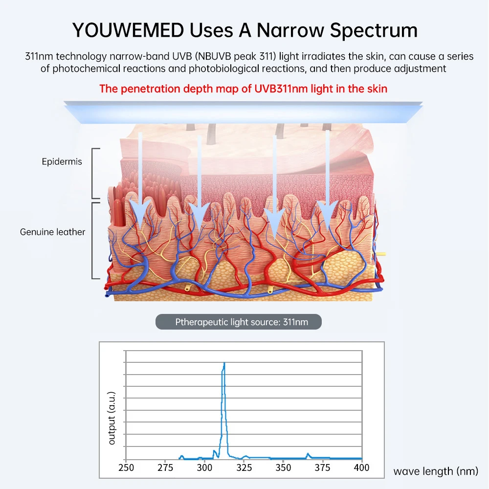 YOUWEMD 311NM UVB Phototherapy Lamp Device for Vitiligo Treatment UV NarrowBand Ultraviolet Light Therapy Psoriasis Spots Eczema