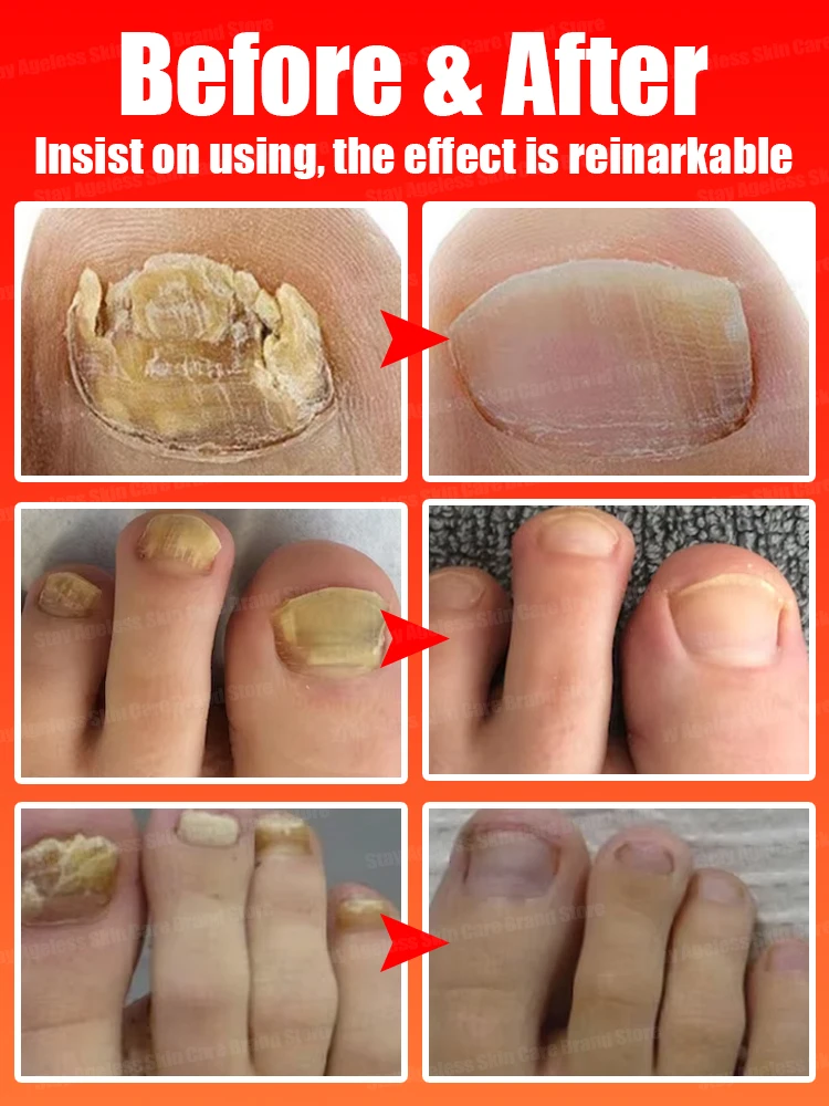 Nга80)HR's: Aга80) NadenniumSJobs Jobs MarktC, SNPrevious