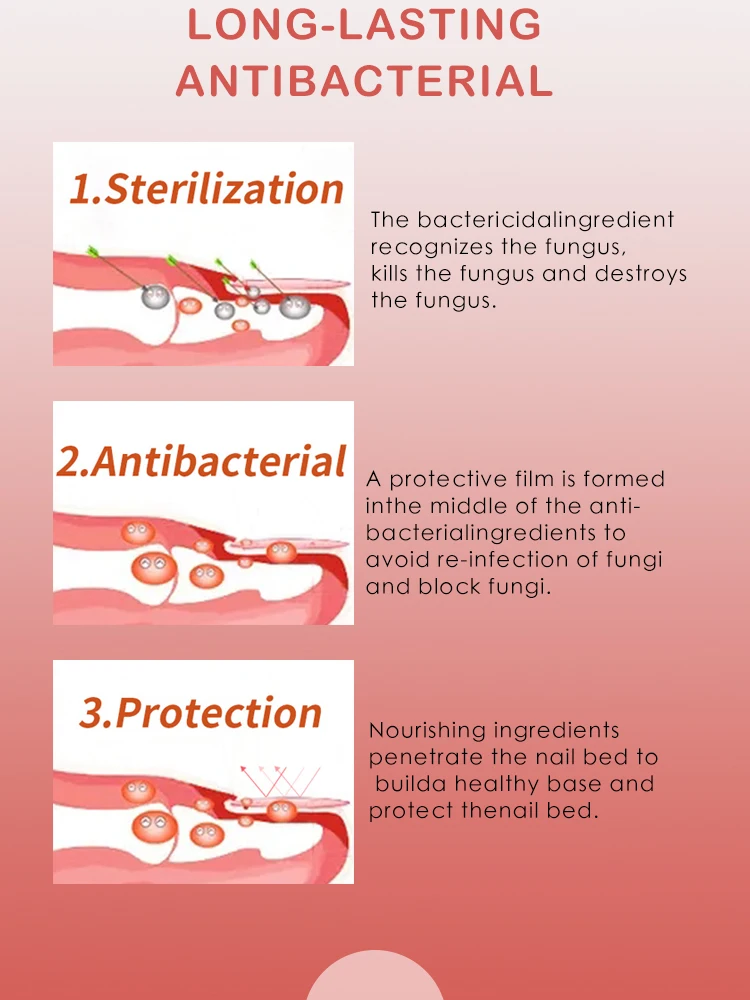 Fungal Nail Infections Reducing