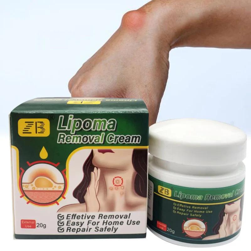 ZB 20g Pure Natural Chinese Herbal Lipoma Removal Cream Efficiently Removes Lipoma Fibroids Subcutaneous Lumps Body Health Care