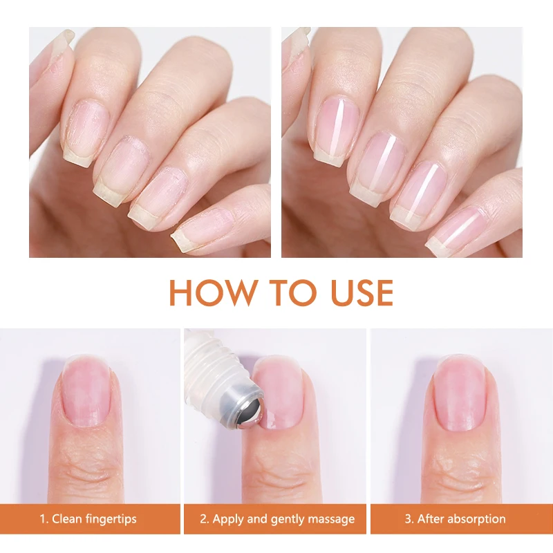 CHUNSHU لامع احباط فيتامين بشرة الأظافر النفط تغذي استعادة الأظافر التالفة 10 مللي العناية بالأظافر تنشيط النفط يرطب القوة