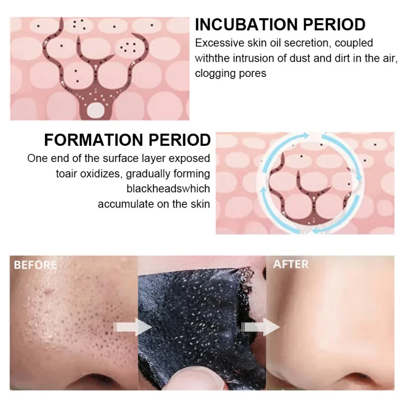 Mascarilla eliminadora de espinillas de nariz, 10/30/50/100 Uds., reduce los poros, puntos negros, elimina rápidamente los puntos negros, tiras de limpieza profunda