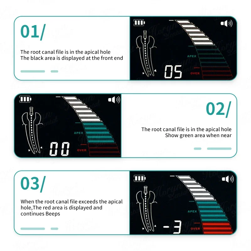 Premium Laboratory Endo Apex Locator Measuring Instrument LCD Screen Root Canal Apex Location Dentistrys Tools